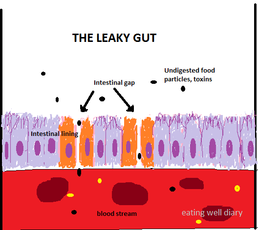 The Leaky Gut, Immunity And More on the Gluten Issue